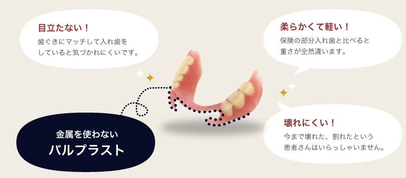金属を使わない バルプラスト