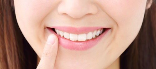 ささじま歯科のホワイトニング